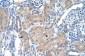 SLA antibody - N-terminal region